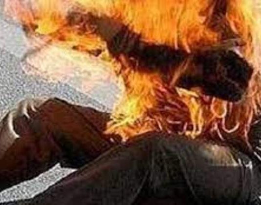 أضرم النار بجسده بالكامل بسبب خلاف مع زوجته!